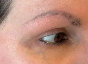 Antes